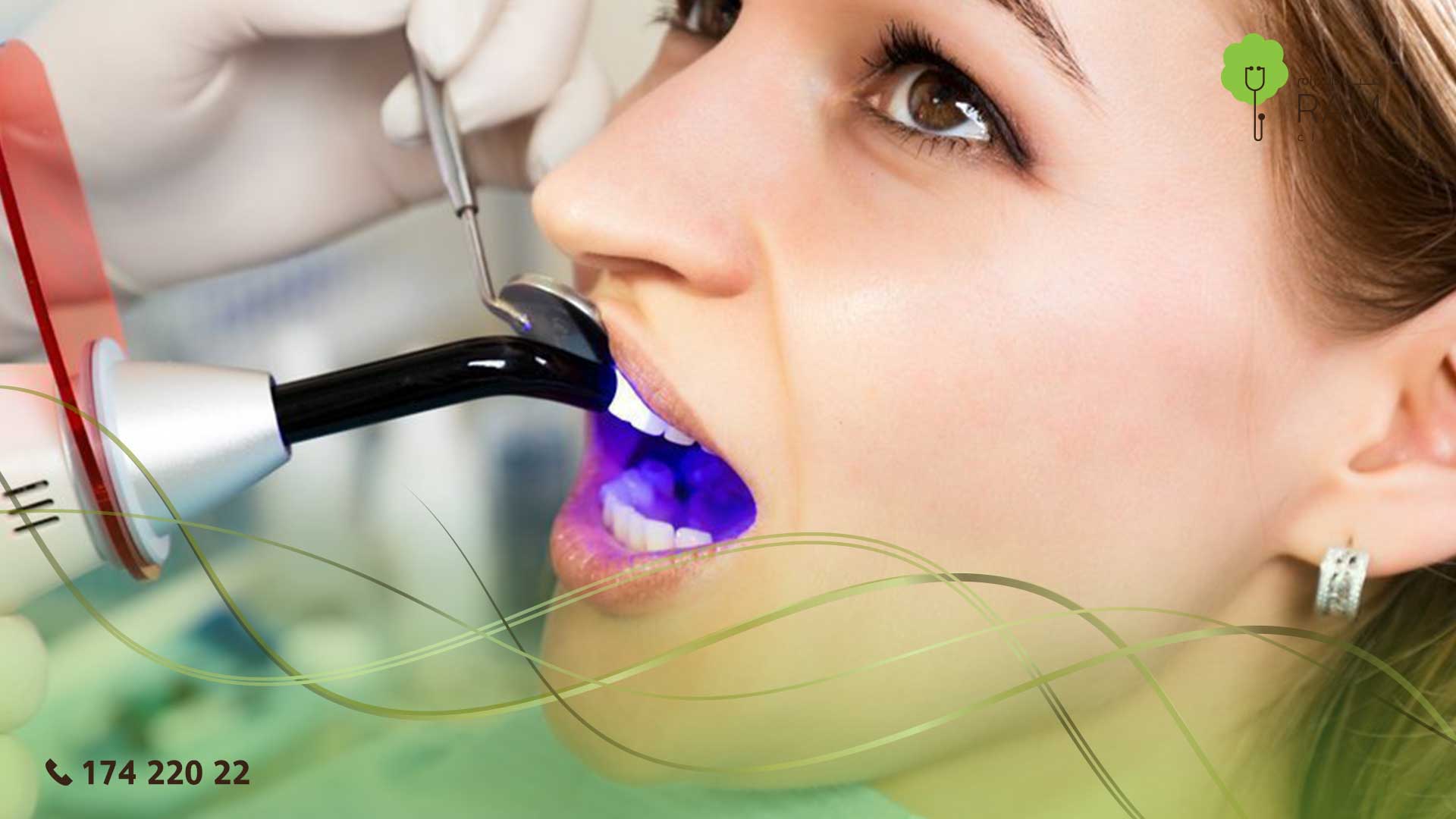 تنظيف الأسنان