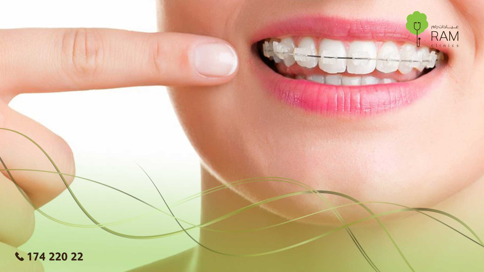 تقويم الاسنان دليلك الشامل