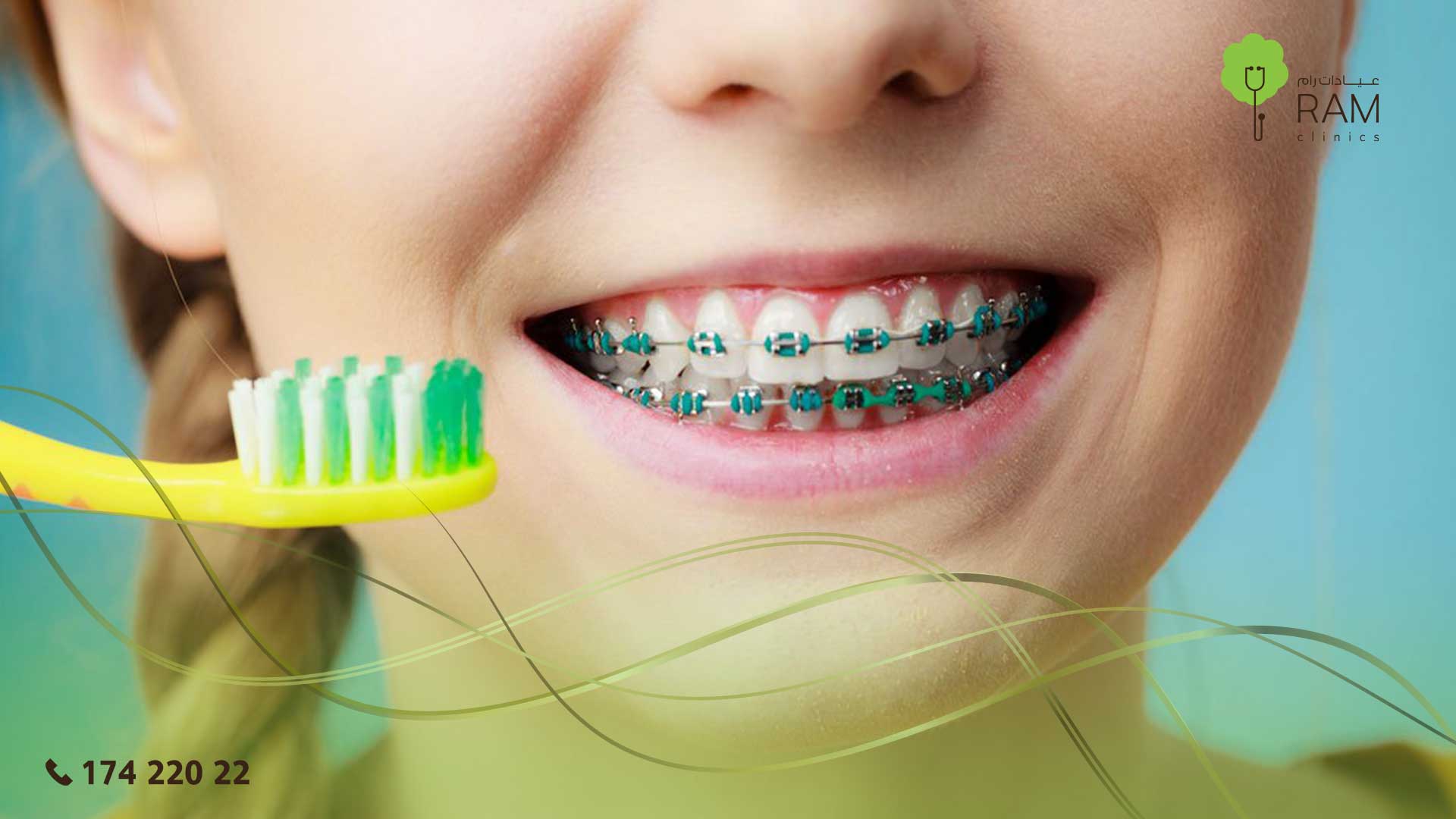 تقويم الأسنان للأطفال