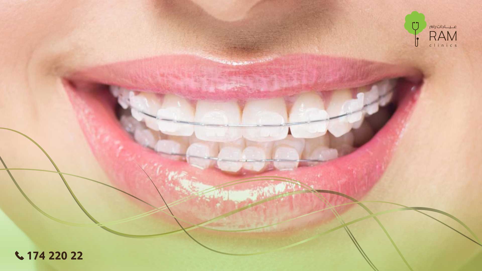 التقويم الثابت