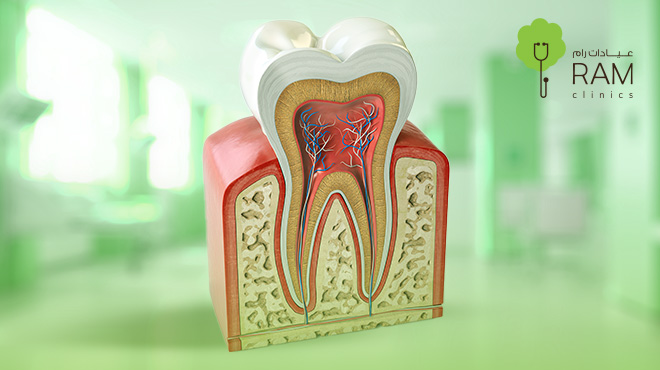 خلع ضرس العقل