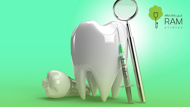أنواع زراعة الأسنان: الأنواع، الطرق، واسعار زراعة الأسنان في عيادة رام