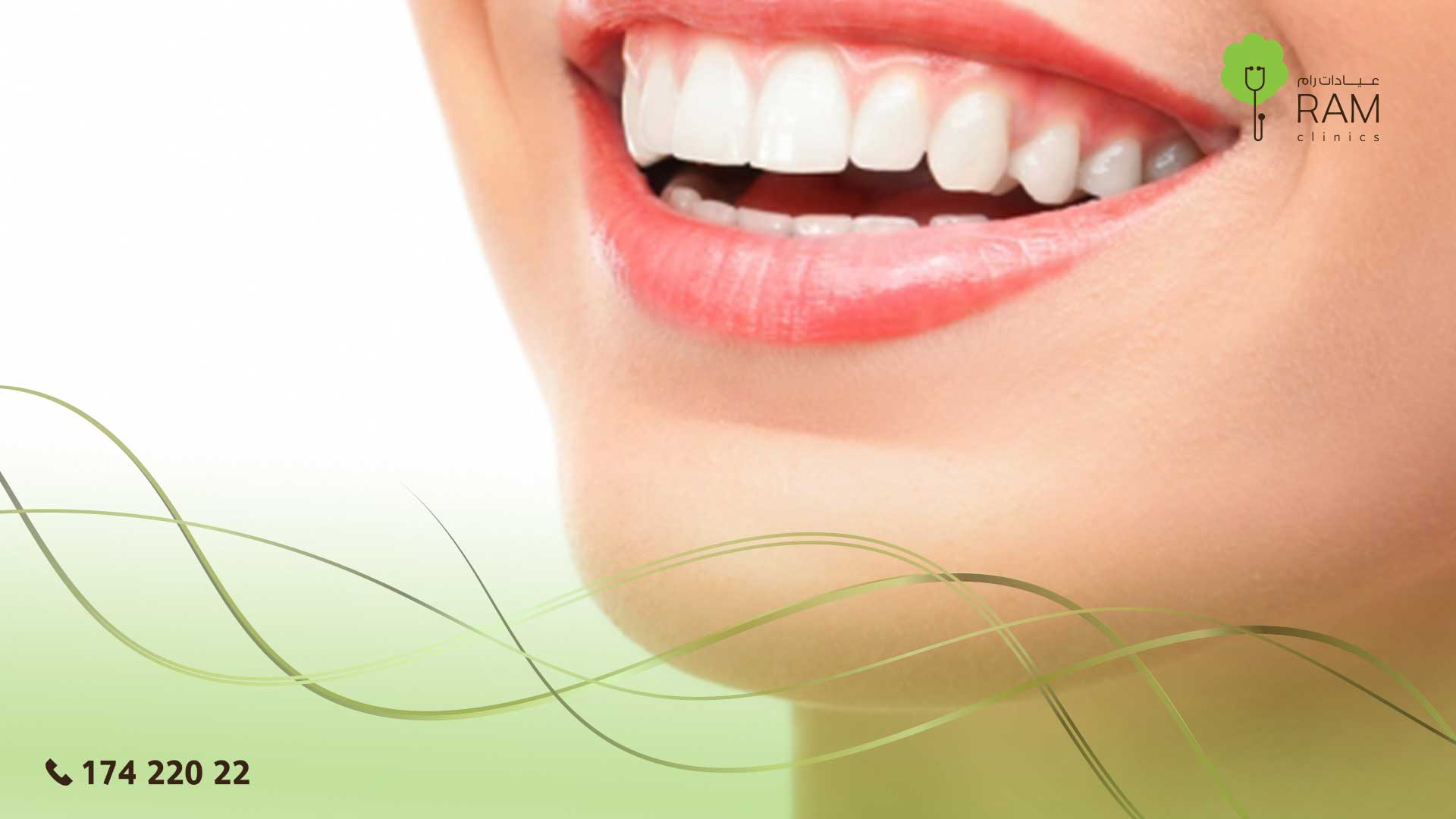 برد الأسنان