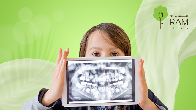 أشعة-البانورما