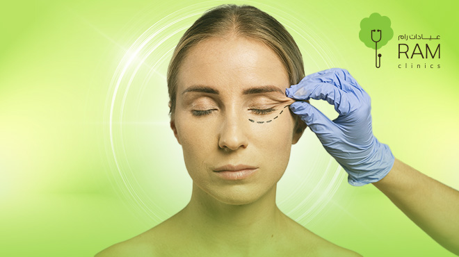 عملية-شد-الجفون-قبل-وبعد