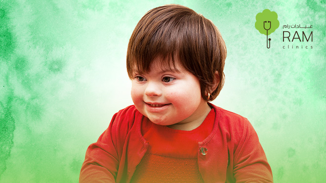 أنواع-متلازمة-داون