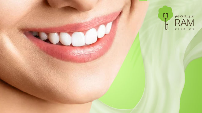 أنواع تبييض الأسنان