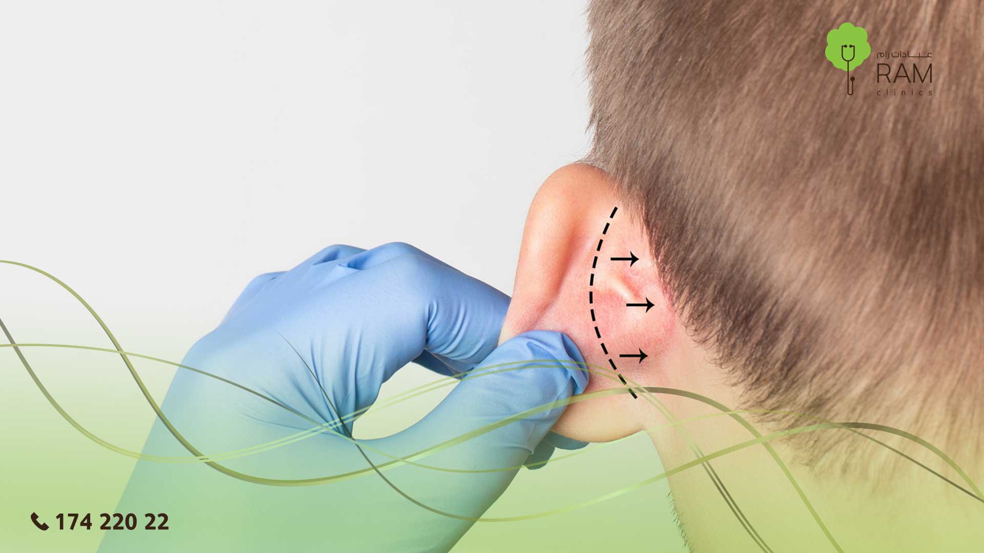 عملية تجميل الأذن