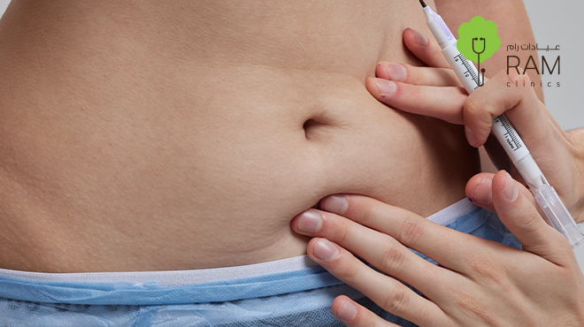 عملية شد البطن